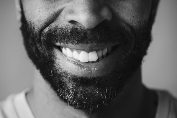 Closeup of smiling teeth of a man
